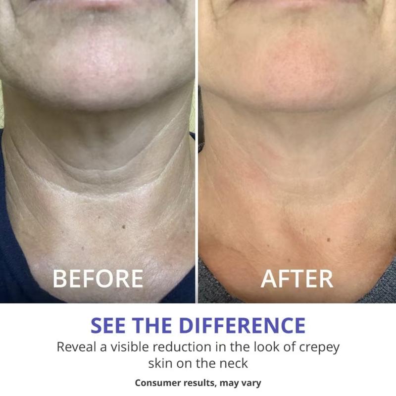 Neck Cream-Tighten & Lift Firming for Crepey Skin